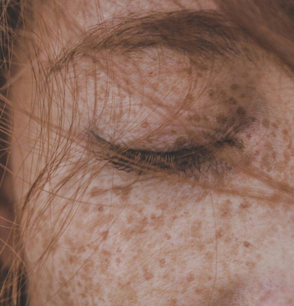 femme avec des tâches de rousseur